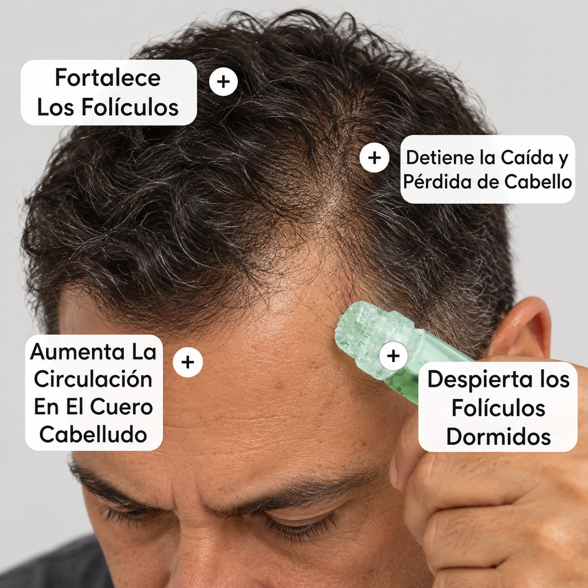 Adiós a las Entradas Marcadas, la Coronilla que se Trasluce y los Folículos Debilitados